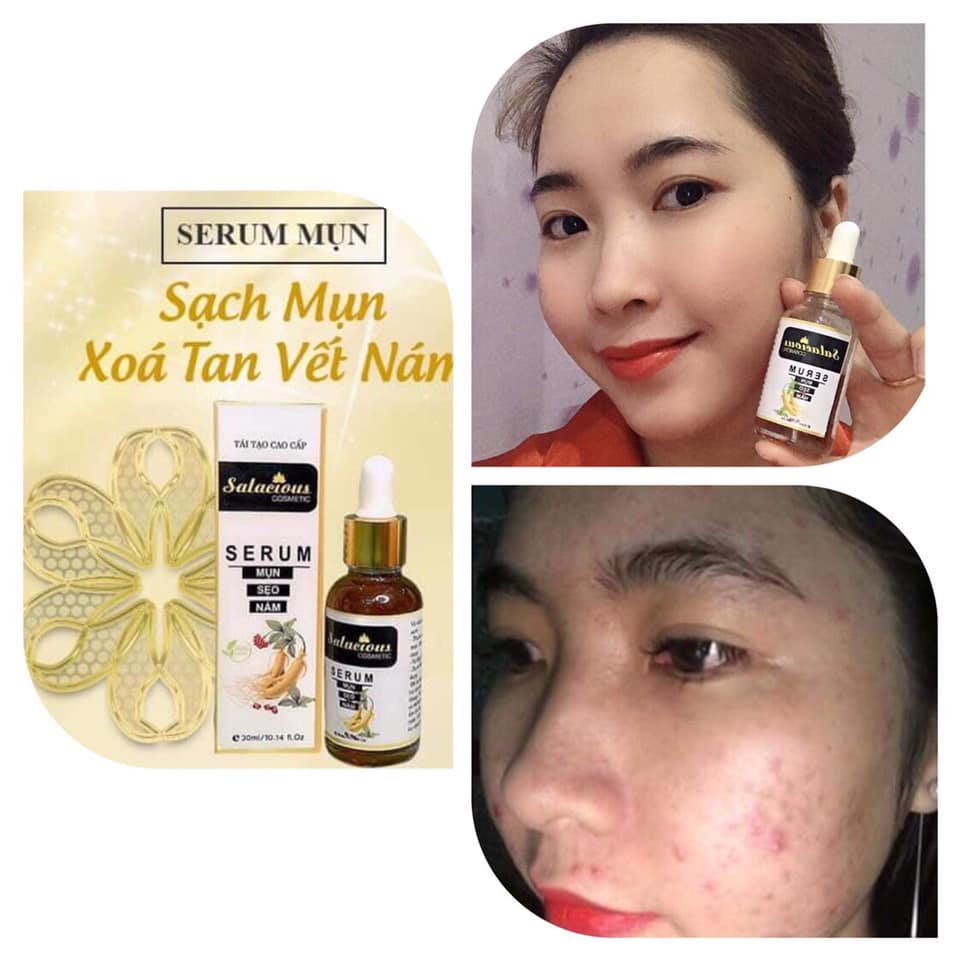 SALACIOUS COSMETIC ANCE TREATMENT SERUM MADE IN KOREA - 30ml/10.14 fl. Oz