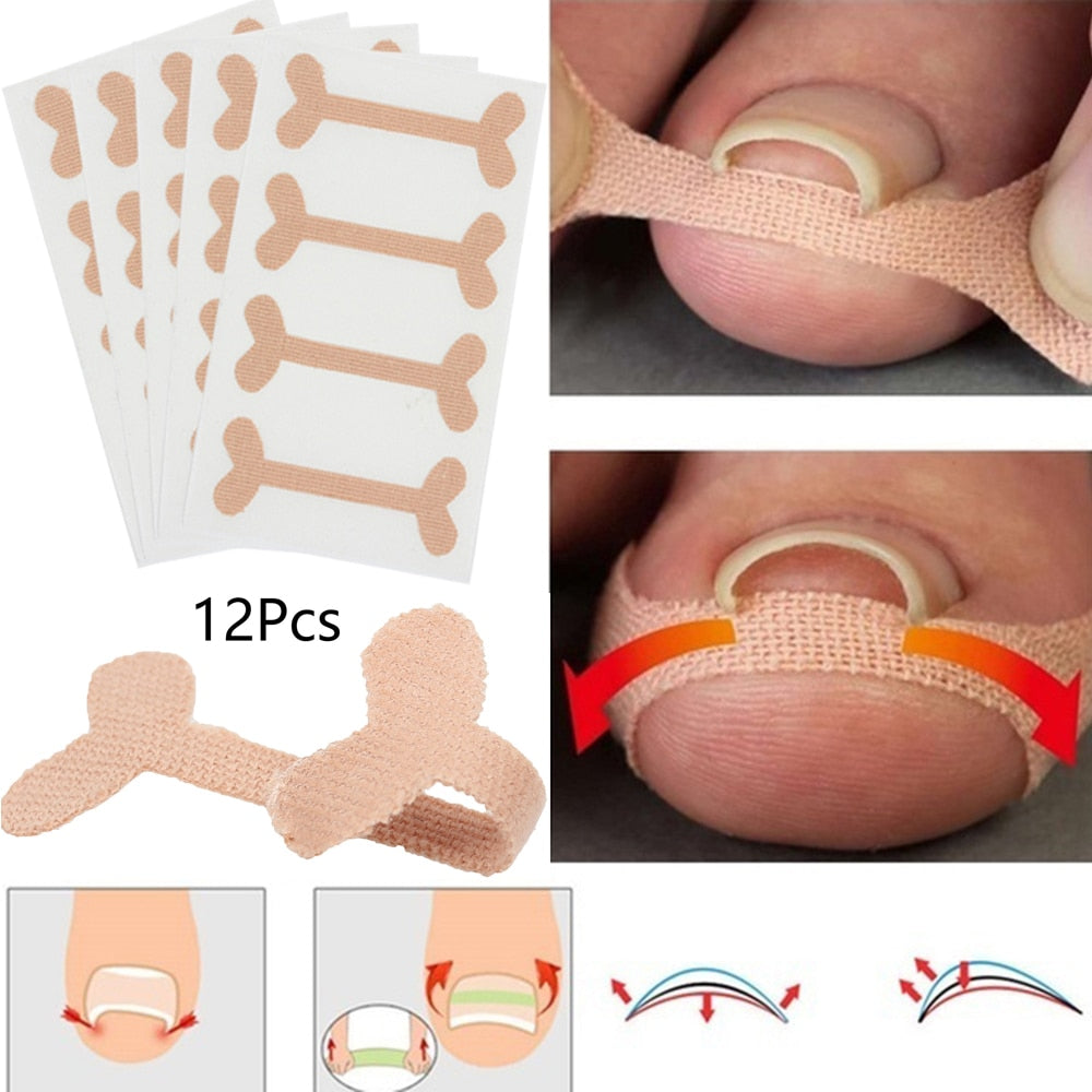 12pcs Ingrown Toenails Band Aid Relief Pain Paronychia Correction Pedicure Elastic Force Sticker Repair Bandage Toe Nail Care